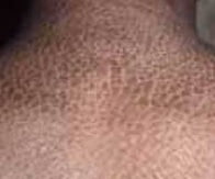 balık pulluluk balık pulluluk